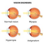 Refractive Errors - Stereo Optical